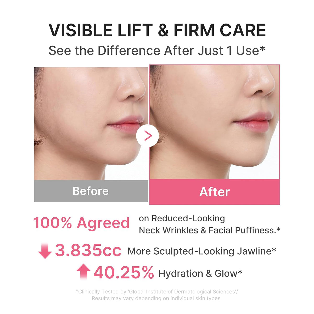 Medicube PDRN Collagen Gua Sha Neck Wrinkle Cream | Built-In Gua Sha Massager with Volufiline 5% + PDRN | Firming, Contour Care | Massage Cream | Korean Skincare
